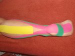 Bild: Kinesiotape – Schmerzbehandlung ohne Wirkstoffe